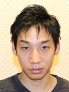 フェイスラインのカバー術