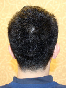 UKストリート風刈り上げ