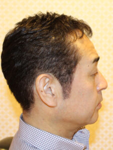 クセっ毛さんのおしゃれ術