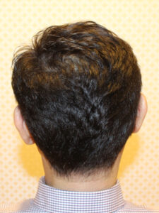 クセっ毛さんのおしゃれ術