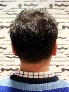 くせっ毛ショート